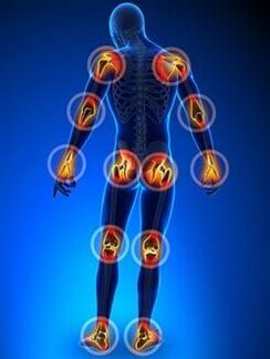 Lokalisierung von von Arthrose betroffenen Gelenke