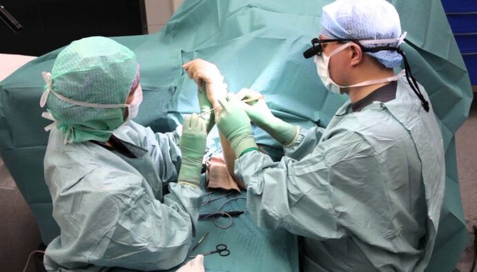 chirurgische Behandlung von Schmerzen in den Fingergelenken