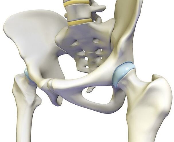 Osteochondrose provoziert einen starken Schmerz im Hüftgelenk